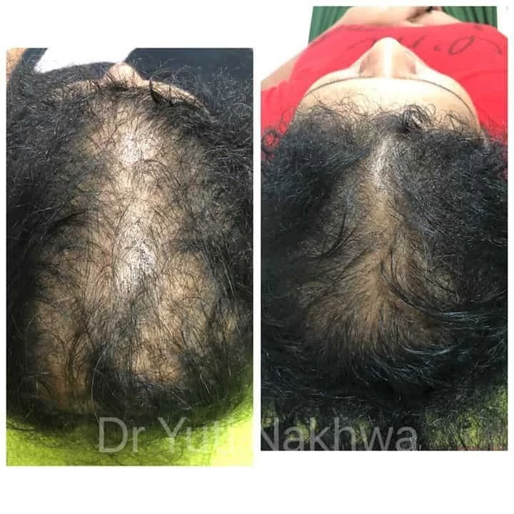 Dr. Yuti Nakhwa - Elixir Skin And Hair Clinic (Dermatologist Skin Cosmetic  & Hair specialist Dadar) - 8 Reviews, Price, Map, Adress in Dadar, Mumbai |  