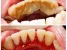 Impressions Dental Care | Dental Clinic in Dadar | Best Dentist in Dadar | Dental Implants in Dadar Photo 3
